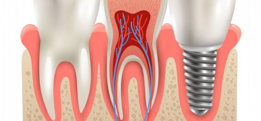 PARODONTOLOGIA